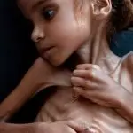 La piccola Amal. Le nostre armi e la nostra grande ipocrisia